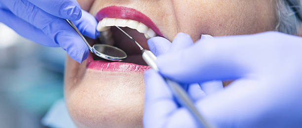 Best Emergency Tooth Extraction in Ridge Manor, FL